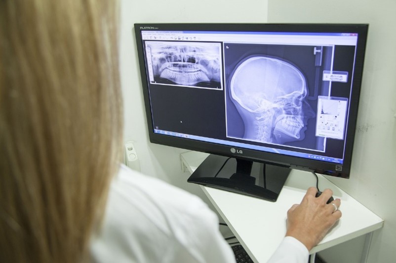 Innovative Radiotherapy Method Potentially Halves Treatment Duration for Head and Neck Cancer